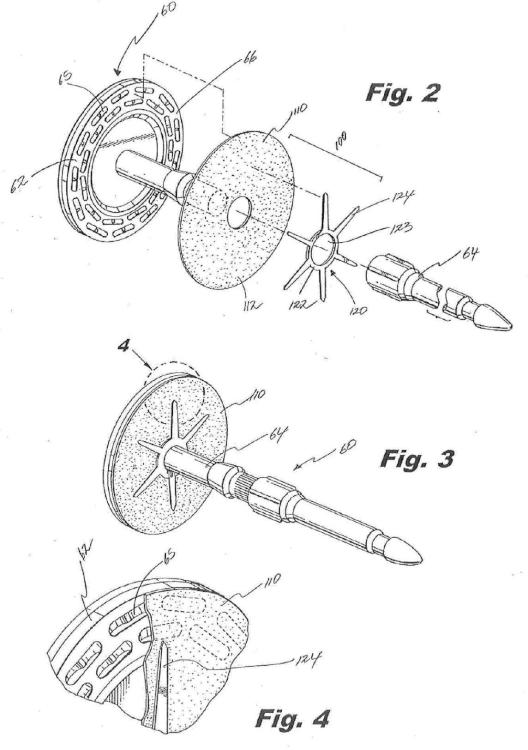 Ilustración 2 de la Galería de ilustraciones de Diseño de soporte de contrafuerte para un yunque de una grapadora quirúrgica
