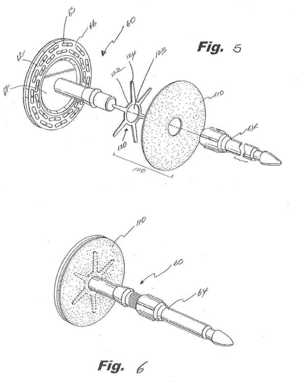 Ilustración 3 de la Galería de ilustraciones de Diseño de soporte de contrafuerte para un yunque de una grapadora quirúrgica
