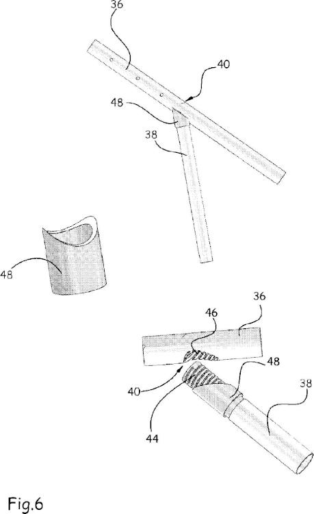 Ilustración 6 de la Galería de ilustraciones de Dispositivo implantable para el tratamiento preventivo o curativo de fracturas del fémur, ancilar asociado