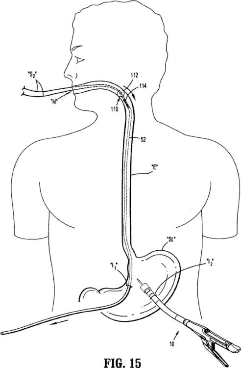 Ilustración 9 de la Galería de ilustraciones de Conjunto de yunque inclinable quirúrgico