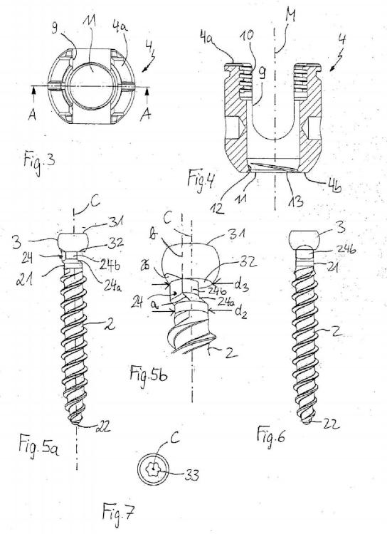 Ilustración 2 de la Galería de ilustraciones de Elemento de anclaje adecuado para ser utilizado en un dispositivo de anclaje de hueso poliaxial y dispositivo de anclaje de hueso poliaxial con un ángulo de giro ampliado hacia un lado