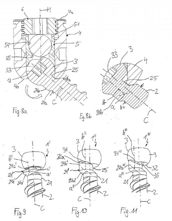 Ilustración 3 de la Galería de ilustraciones de Elemento de anclaje adecuado para ser utilizado en un dispositivo de anclaje de hueso poliaxial y dispositivo de anclaje de hueso poliaxial con un ángulo de giro ampliado hacia un lado