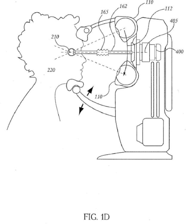 Ilustración 4 de la Galería de ilustraciones de Radiocirugía ocular