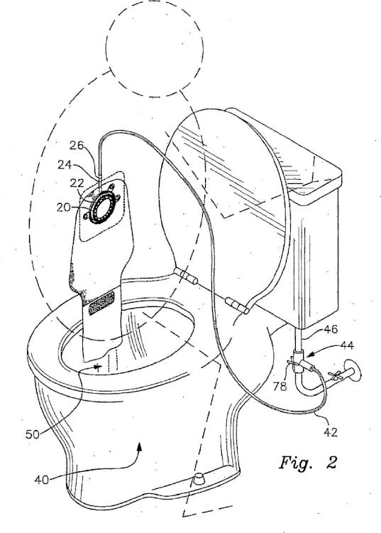 Ilustración 2 de la Galería de ilustraciones de Sistema de limpieza de bolsa de colostomía