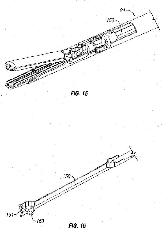 Ilustración 8 de la Galería de ilustraciones de Aparato para articular la muñeca de un instrumento de agarre laparoscópico