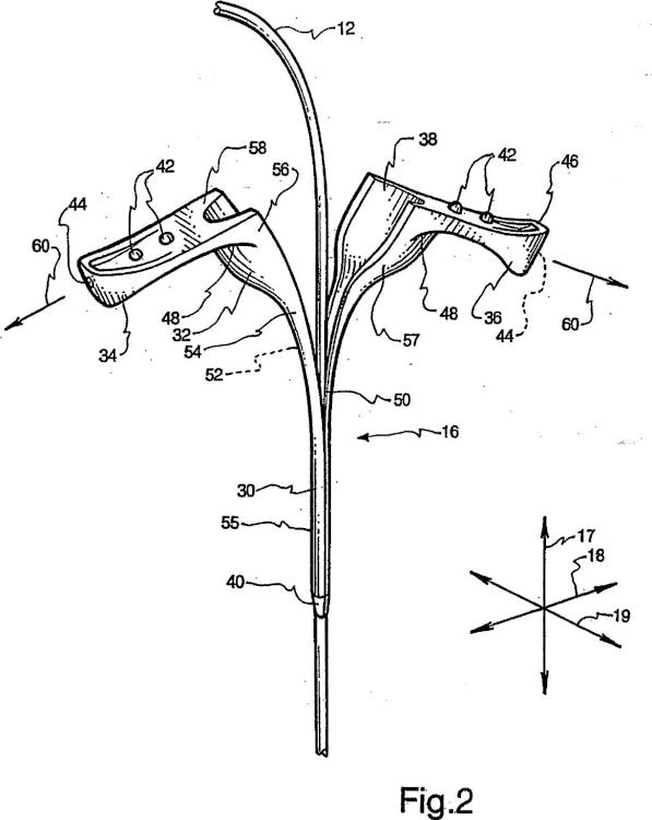 Ilustración 2 de la Galería de ilustraciones de Proceso de moldeo por inyección en un único paso para fabricar una vaina de catéter