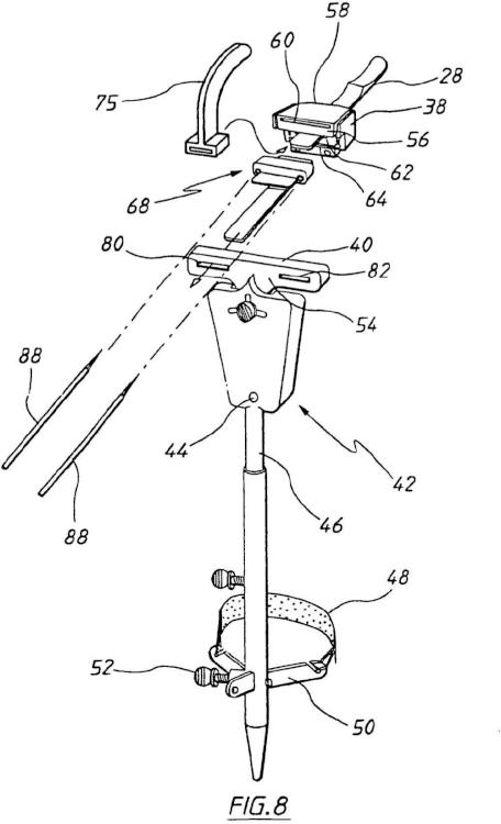 Ilustración 5 de la Galería de ilustraciones de Aparato para uso en artroplastia en una articulación de rodilla