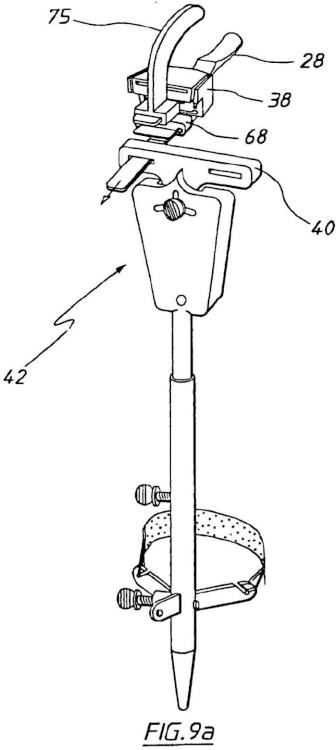 Ilustración 6 de la Galería de ilustraciones de Aparato para uso en artroplastia en una articulación de rodilla