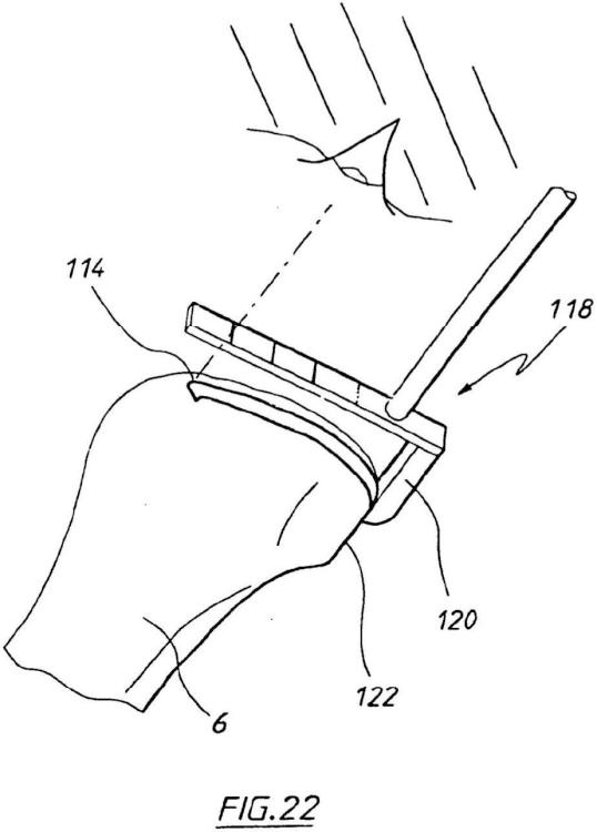 Ilustración 14 de la Galería de ilustraciones de Aparato para uso en artroplastia en una articulación de rodilla