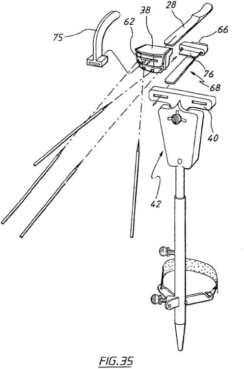 Ilustración 23 de la Galería de ilustraciones de Aparato para uso en artroplastia en una articulación de rodilla