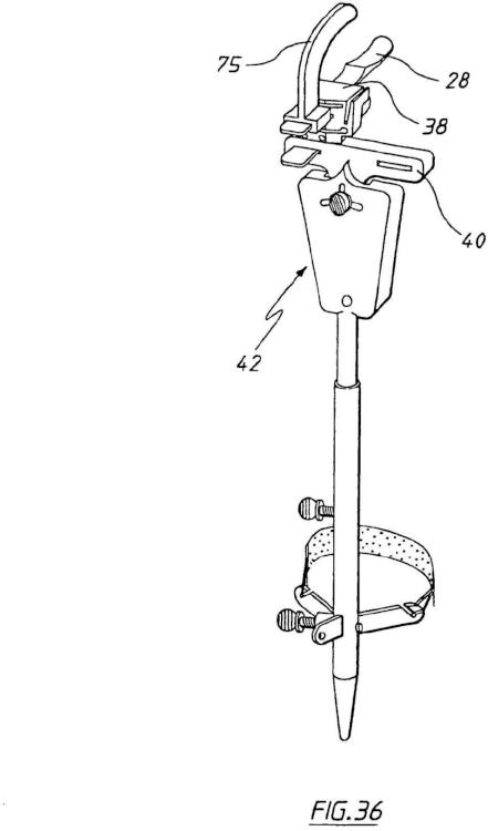 Ilustración 24 de la Galería de ilustraciones de Aparato para uso en artroplastia en una articulación de rodilla
