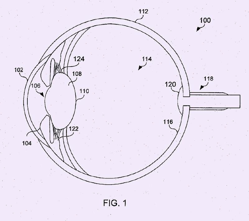 Diseño difractivo de distancia central con desplazamiento de fase para implante ocular.