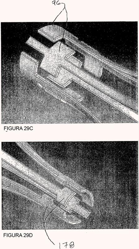 Ilustración 2 de la Galería de ilustraciones de Sistema de remodelación y / o ablación excéntrica seleccionable de material ateroesclerótico