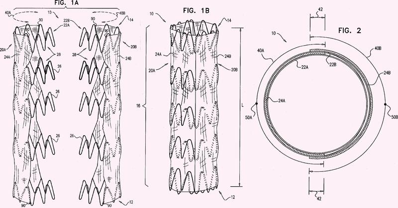 Sistema endovascular con endoprótesis que solapan circunferencialmente.