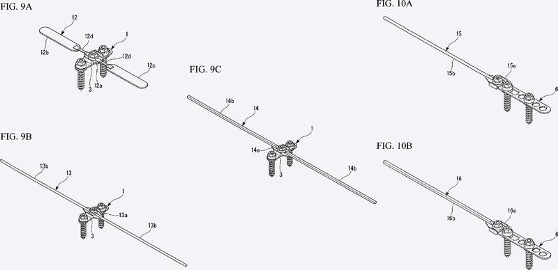 Estructura de implante ortodóncico.