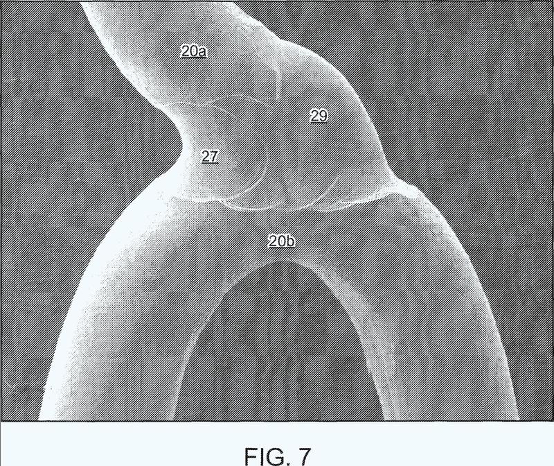 Ilustración 3 de la Galería de ilustraciones de Método para conformar un stent y un stent obtenido con dicho método