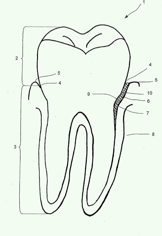Composición farmacéutica para el tratamiento de enfermedades periodontales o periimplantarias.