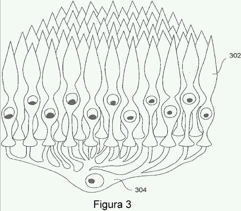 Ilustración 2 de la Galería de ilustraciones de Aparato para limitar el crecimiento de la longitud del ojo