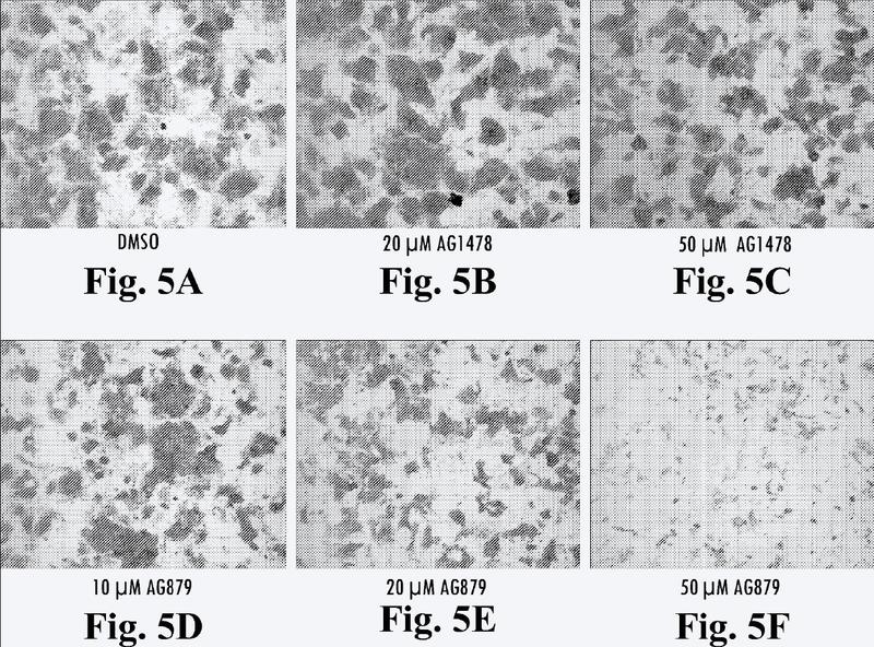 Composiciones de suspensión de agregados de células madre y métodos para su diferenciación.