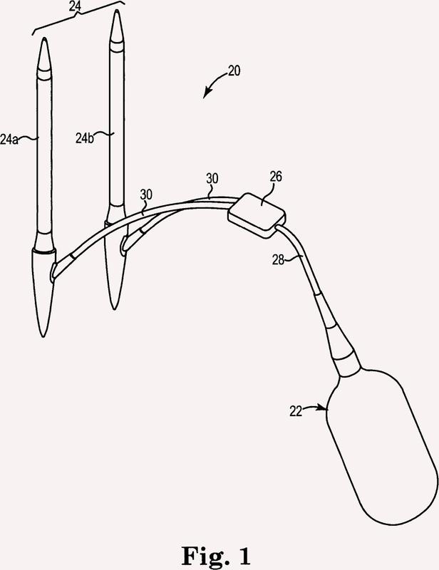 Ilustración 4 de la Galería de ilustraciones de Prótesis de pene inflable de manera peristáltica