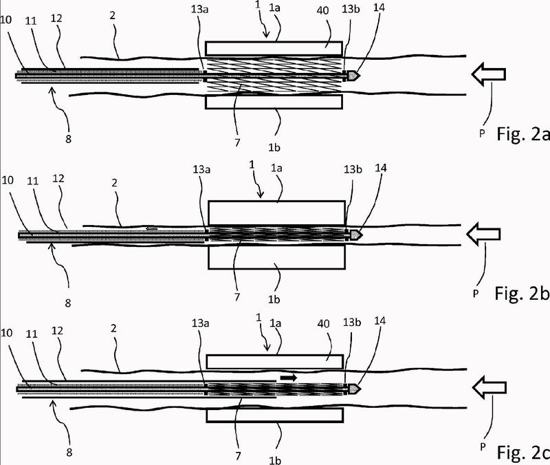 Ilustración 2 de la Galería de ilustraciones de Disposición y procedimiento para preparar una endoprótesis para implantación con una envuelta