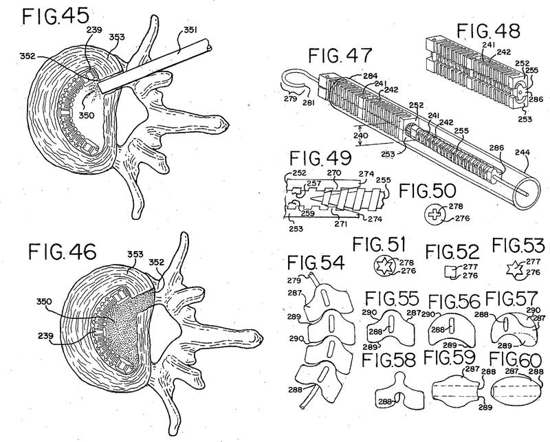 Ilustración 3 de la Galería de ilustraciones de Dispositivos para tratar la columna vertebral