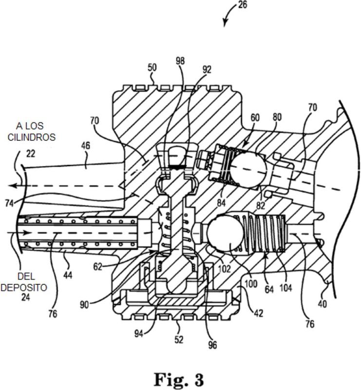 Ilustración 1 de la Galería de ilustraciones de Conjunto válvula de cierre de prótesis de pene implantable