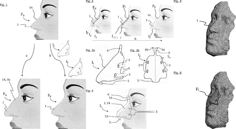 Conjunto de instrumentos de modelado de la nariz, procedimiento de realización y procedimiento de modelado de la nariz.