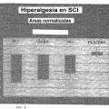 Ilustración 1 de TRATAMIENTO DEL DOLOR NEUROPÁTICO CON ANTAGONISTAS DEL RECEPTOR DE N-METIL-D-ASPARTATO (NMDA)