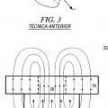 Ilustración 2 de Optimización del perfil de campo en un desacoplador magnético de alta intensidad de campo