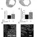 Ilustración 12 de SDF-1 para su uso en el tratamiento de trastornos vasculares periféricos isquémicos
