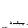 Ilustración 3 de Gen de fusión EML4-ALK