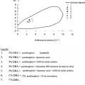 Ilustración 6 de Composiciones cosméticas y procedimientos que contienen un agente de bronceado y ácido ursólico encapsulado en liposoma