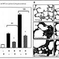 Ilustración 6 de Empleo de trifluormetilcetonas específicas para la prevención y tratamiento de una pancreatitis.