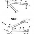Ilustración 4 de Implante de articulación facetaria.