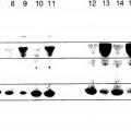 Ilustración 4 de Glicosilación de péptidos a través de secuencias de glicosilación con unión en O