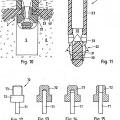 Ilustración 7 de Dispositivo de fijación de un anclaje de sutura en un tejido duro
