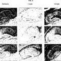 Ilustración 4 de Uso de epotilona D en el tratamiento de enfermedades asociadas a Tau incluyendo enfermedad de Alzheimer.