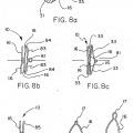 Ilustración 7 de Dispositivo implantable con filamento enrollado