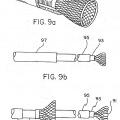 Ilustración 8 de Dispositivo implantable con filamento enrollado