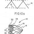 Ilustración 11 de Dispositivo implantable con filamento enrollado