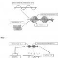 Ilustración 1 de Dispositivo de separación/detección automática de ruido de una onda de radio.