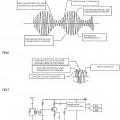 Ilustración 3 de Dispositivo de separación/detección automática de ruido de una onda de radio.