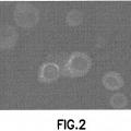 Ilustración 2 de Células madre mesenquimales CD34 negativas modificadas genéticamente para el tratamiento de tumores.
