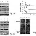 Ilustración 1 de La actividad neuroprotectora de la proteína C activada es independiente de su actividad anticoagulante