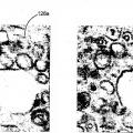 Ilustración 7 de Identificación y clasificación de partículas víricas en micrografías electrónicas texturizada