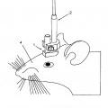 Ilustración 8 de Aparato para microscopia de manojos de fibras de cerebro