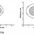 Ilustración 7 de Sistemas de microsonda criogénica dérmica y transdérmica