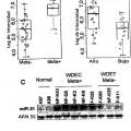 Ilustración 4 de Anomalías de la expresión de microARN en tumores pancreáticos endocrinos y acinares.