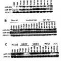 Ilustración 6 de Anomalías de la expresión de microARN en tumores pancreáticos endocrinos y acinares